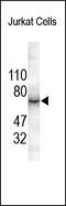 Interleukin 6 Receptor antibody, 252201, Abbiotec, Western Blot image 