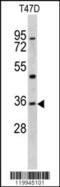 Kruppel Like Factor 6 antibody, 62-348, ProSci, Western Blot image 