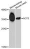 Aminoacylase 3 antibody, A5084, ABclonal Technology, Western Blot image 