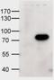 ATP Binding Cassette Subfamily D Member 1 antibody, orb19947, Biorbyt, Western Blot image 
