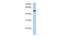 Polypeptide N-Acetylgalactosaminyltransferase 13 antibody, PA5-43522, Invitrogen Antibodies, Western Blot image 