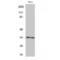 Cyclin Dependent Kinase 1 antibody, LS-C380662, Lifespan Biosciences, Western Blot image 