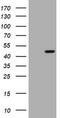 Gamma-Butyrobetaine Hydroxylase 1 antibody, TA505789, Origene, Western Blot image 