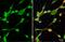 Matrix Metallopeptidase 2 antibody, GTX636525, GeneTex, Immunofluorescence image 
