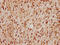 SRSF Protein Kinase 2 antibody, CSB-PA022683LA01HU, Cusabio, Immunohistochemistry paraffin image 