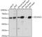 Zinc finger and SCAN domain-containing protein 21 antibody, A11874, Boster Biological Technology, Western Blot image 