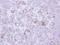 Matrix Metallopeptidase 13 antibody, NBP2-17310, Novus Biologicals, Immunohistochemistry frozen image 