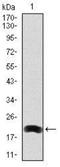 Low-density lipoprotein receptor-related protein 5 antibody, NBP2-37510, Novus Biologicals, Western Blot image 