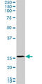 Phosphomannomutase 2 antibody, LS-C139428, Lifespan Biosciences, Western Blot image 