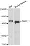 Caspase Recruitment Domain Family Member 11 antibody, abx005391, Abbexa, Western Blot image 