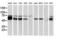 Catalase antibody, LS-C172722, Lifespan Biosciences, Western Blot image 