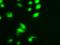 Ubiquitin B antibody, BML-PW1335-0025, Enzo Life Sciences, Immunocytochemistry image 