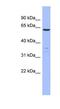 Plastin 1 antibody, NBP1-56555, Novus Biologicals, Western Blot image 