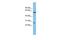 Chymotrypsinogen B1 antibody, GTX47748, GeneTex, Western Blot image 