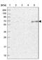 Electron Transfer Flavoprotein Dehydrogenase antibody, NBP1-83950, Novus Biologicals, Western Blot image 