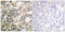 Mucin 1, Cell Surface Associated antibody, 79-825, ProSci, Immunohistochemistry frozen image 
