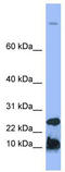 Hepcidin Antimicrobial Peptide antibody, TA346137, Origene, Western Blot image 