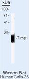TIMP Metallopeptidase Inhibitor 1 antibody, MA5-13685, Invitrogen Antibodies, Western Blot image 