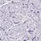Ankyrin Repeat Domain 45 antibody, HPA031656, Atlas Antibodies, Immunohistochemistry paraffin image 