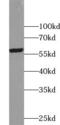 Aldehyde dehydrogenase family 1 member A3 antibody, FNab00286, FineTest, Western Blot image 