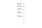 Zinc Finger Protein 419 antibody, 28-414, ProSci, Western Blot image 