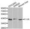F11 Receptor antibody, A1241, ABclonal Technology, Western Blot image 