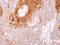 Serine Protease 8 antibody, GTX103976, GeneTex, Immunohistochemistry paraffin image 