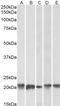 Ferritin Light Chain antibody, PA5-19059, Invitrogen Antibodies, Western Blot image 