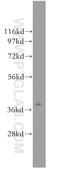 Asialoglycoprotein Receptor 2 antibody, 11501-2-AP, Proteintech Group, Western Blot image 