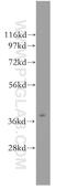 Asialoglycoprotein receptor 2 antibody, 11501-2-AP, Proteintech Group, Western Blot image 