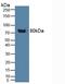 Glycoprotein Ib Platelet Subunit Alpha antibody, MBS2027978, MyBioSource, Western Blot image 