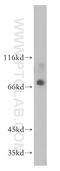 Zinc finger protein 64 homolog, isoforms 1 and 2 antibody, 17187-1-AP, Proteintech Group, Western Blot image 