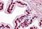 Mothers against decapentaplegic homolog 6 antibody, orb89639, Biorbyt, Immunohistochemistry paraffin image 
