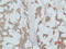Phosphoinositide-3-Kinase Regulatory Subunit 1 antibody, STJ97432, St John