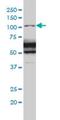 RAS P21 Protein Activator 1 antibody, H00005921-M01, Novus Biologicals, Western Blot image 