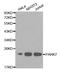 Parkinsonism Associated Deglycase antibody, A0987, ABclonal Technology, Western Blot image 