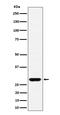 Glutamate-Cysteine Ligase Modifier Subunit antibody, M02948-2, Boster Biological Technology, Western Blot image 