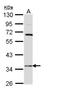 Hydroxysteroid 17-Beta Dehydrogenase 6 antibody, NBP1-31672, Novus Biologicals, Western Blot image 