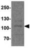 Phosphofurin Acidic Cluster Sorting Protein 1 antibody, GTX32158, GeneTex, Western Blot image 