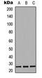 Epstein-Barr Virus Induced 3 antibody, abx121629, Abbexa, Western Blot image 