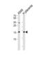 NME/NM23 Nucleoside Diphosphate Kinase 1 antibody, abx028516, Abbexa, Western Blot image 