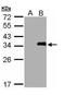 LIM And SH3 Protein 1 antibody, GTX108014, GeneTex, Western Blot image 