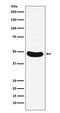 Motor Neuron And Pancreas Homeobox 1 antibody, M04520, Boster Biological Technology, Western Blot image 