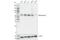 Malic Enzyme 2 antibody, 15506S, Cell Signaling Technology, Western Blot image 