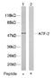 Activating Transcription Factor 2 antibody, AP02573PU-S, Origene, Western Blot image 