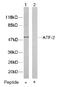 CREB2 antibody, AP02573PU-S, Origene, Western Blot image 