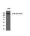 TBC1 Domain Family Member 4 antibody, A02004T642-1, Boster Biological Technology, Western Blot image 