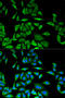 Diazepam Binding Inhibitor, Acyl-CoA Binding Protein antibody, 14-894, ProSci, Immunofluorescence image 