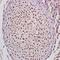 STEAP4 Metalloreductase antibody, orb100950, Biorbyt, Immunohistochemistry paraffin image 