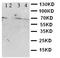 Cystathionine-Beta-Synthase antibody, LS-C312700, Lifespan Biosciences, Western Blot image 